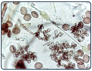 unknown spores